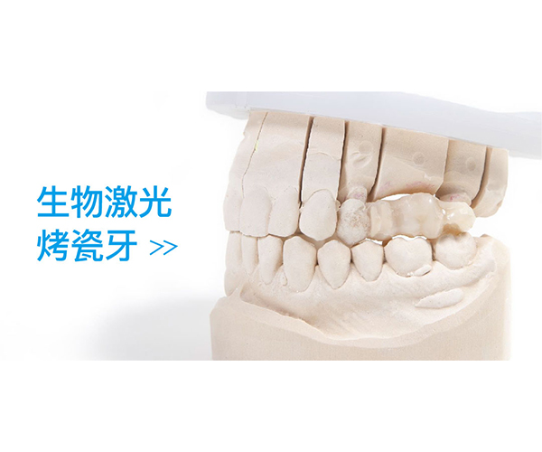 生物激光烤瓷牙