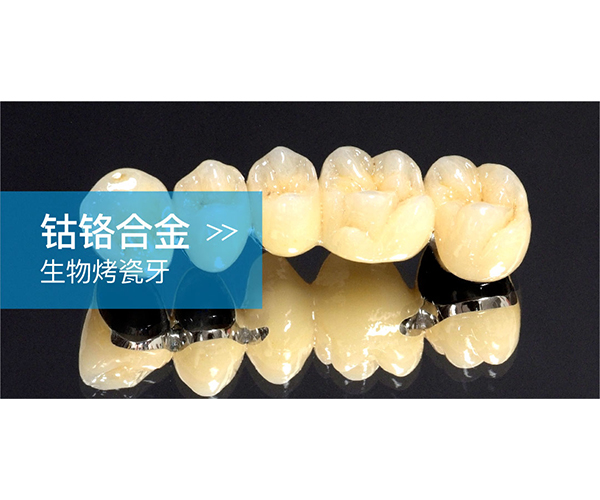 钴铬合金生物烤瓷牙
