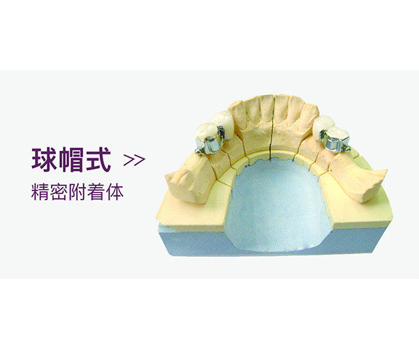 球帽式精密附着体