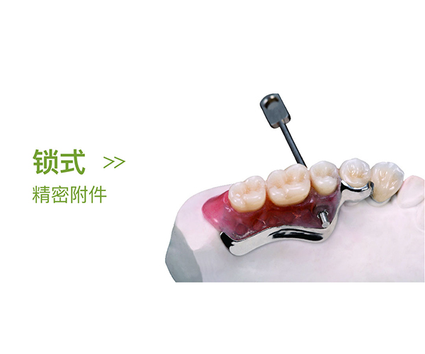 锁式精密附件