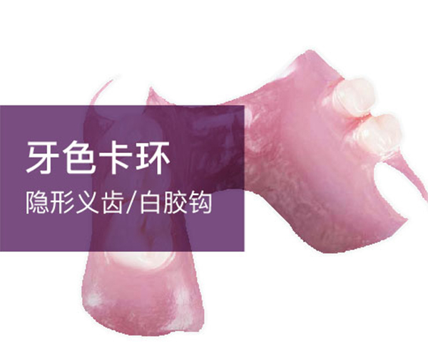 隐形义齿-白胶钩、牙色卡环
