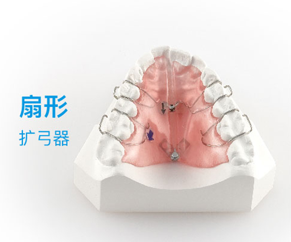 扩弓器-扇形扩弓器
